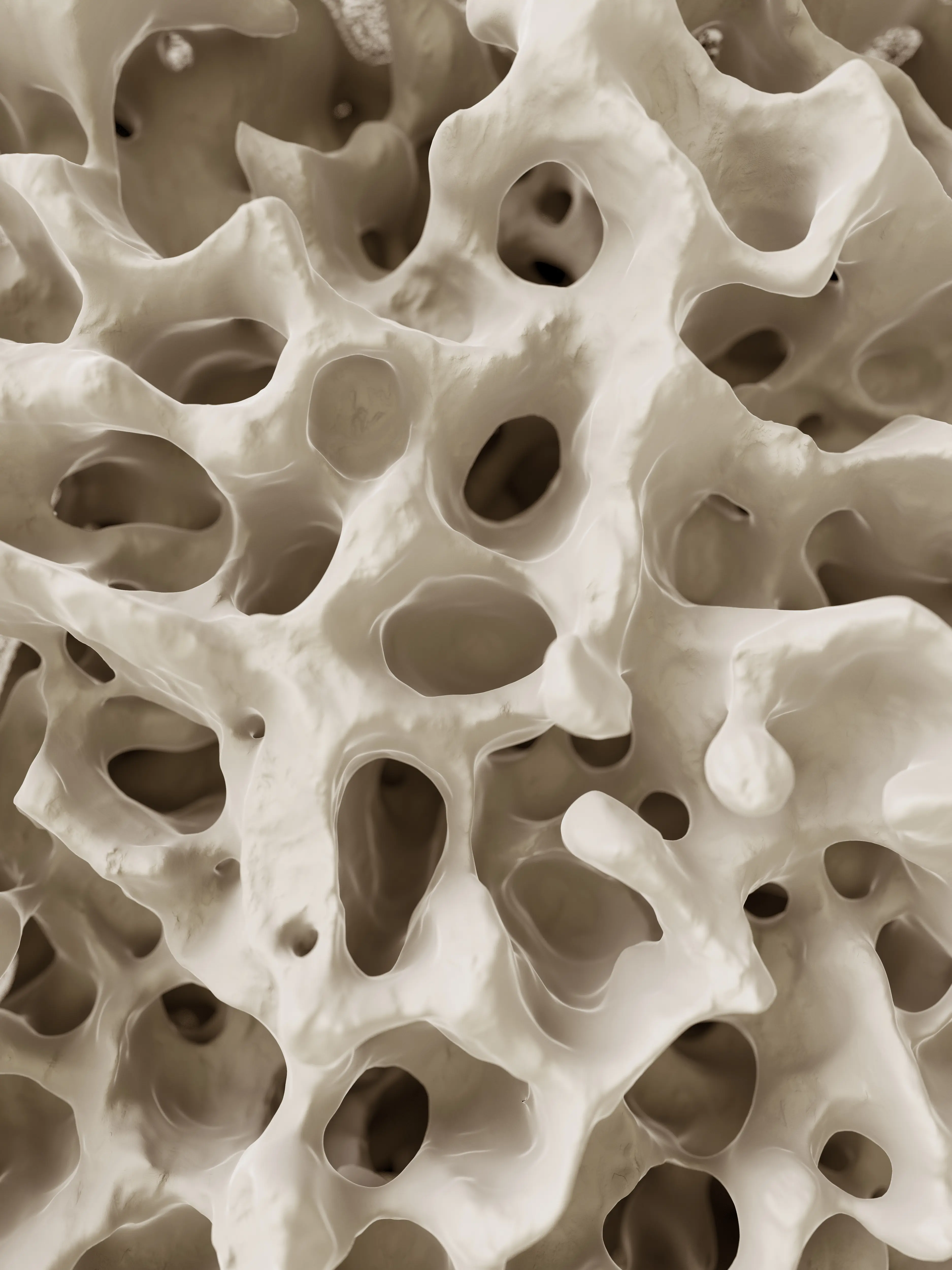 brüchiges Knochenmaterial